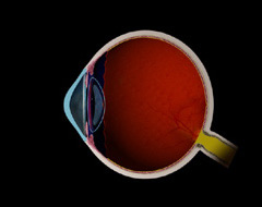Astigmatism